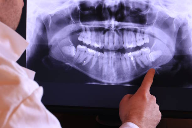 Urgent Tooth Repair in PA